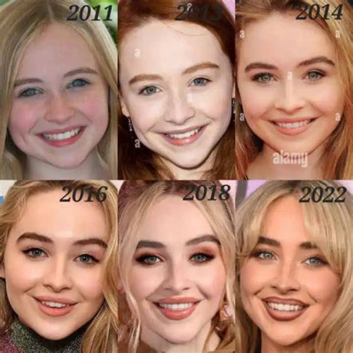 Sabrina Carpenter Plastic Surgery: Breast Augmentations, Lip Fillers, or Glowing Naturally?